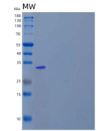 人苹果酸脱氢酶,线粒体/MDH2重组蛋白C-6His