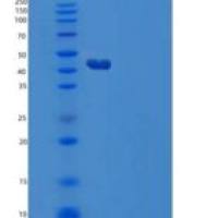 人Serpin A4/Kallistatin重组蛋白C-6His