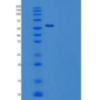人丝氨酸蛋白酶抑制剂B6/胎盘凝血酶抑制剂重组蛋白N-Trx, 6His
