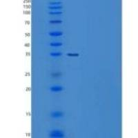 人Carbonic Anhydrase-Related Protein 11/CA11重组蛋白C-6His
