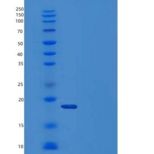 人半乳糖凝集素-14/LGALS14重组蛋白C-6His