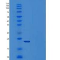 人半乳糖凝集素-14/LGALS14重组蛋白C-6His