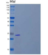 人镁依赖性磷酸酶1/MDP1重组蛋白C-6His