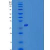 人肌原调节蛋白2(MYOZ2)重组蛋白C-6His