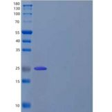 人T-细胞激活连接蛋白家族成员2(LAT2)重组蛋白C-6His