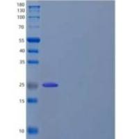 人T-细胞激活连接蛋白家族成员2(LAT2)重组蛋白C-6His