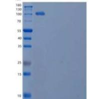 人信号素4B(SEMA4B)重组蛋白C-Fc-6His