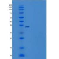 人死亡因子4样蛋白2/MORF4L2/MRGX重组蛋白C-6His