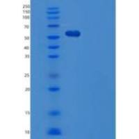 人组织蛋白酶A(CTSA)重组蛋白C-6His