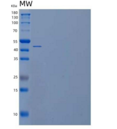 人硒磷酸合酶1/SEPHS1重组蛋白C-6His