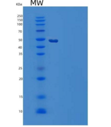 人羧肽酶M(CPM)重组蛋白C-6His