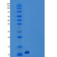 人胃动素(MTL)重组蛋白C-6His