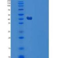 人延胡索二酰乙酰乙酸水解酶(FAH)重组蛋白C-6His