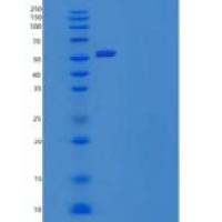 人谷胱甘肽合成酶/谷胱甘肽合成酶重组蛋白C-6His