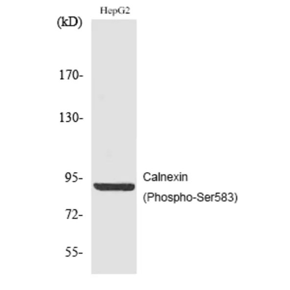 Anti-Calnexin  (Phospho-Ser583) Antibody (A50085)