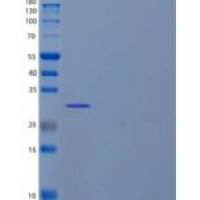 人桥接积分器2/BIN2/BRAP1重组蛋白N-6His