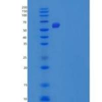 小鼠羧酸酯酶3(CES3)重组蛋白C-6His