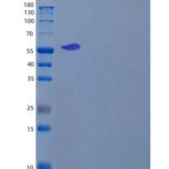 人钙/钙调蛋白依赖性蛋白激酶Ⅱβ(CAMK2b)重组蛋白C-6His