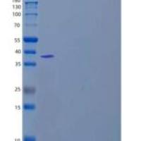 人苹果酸脱氢酶1(MDH1)重组蛋白C-6His