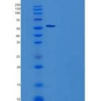 人唾液酸乙酰酯酶(SIAE)重组蛋白C-6His