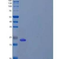 人嗜乳脂蛋白亚家族3成员A2(BTN3A2重组蛋白C-6His