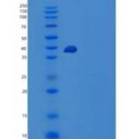 人Geranylgeranyl Pyrophosphate Synthase/GGPS1重组蛋白N-6His