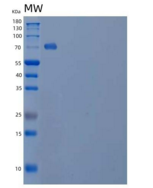 人信号素4B(SEMA4B)重组蛋白C-6His