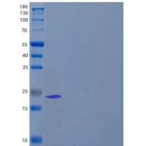 人镁依赖性磷酸酶1/MDP1重组蛋白C-6His