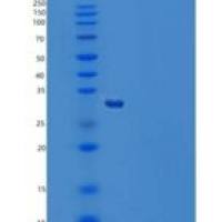 人巨噬细胞集落刺激因子(MCSF)重组蛋白C-6His