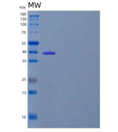 人β-Ureidopropionase/UPB1重组蛋白C-