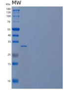 人Carbonic Anhydrase 14/CA14重组蛋