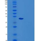 小鼠Carbonic Anhydrase 14/CA14重组蛋白C-6His