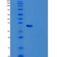 小鼠Carbonic Anhydrase 14/CA14重组蛋白C-6His