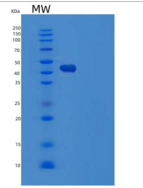人丝氨酸蛋白酶抑制剂A5/蛋白C抑制剂重组蛋白C-6His
