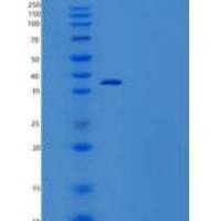 人富含谷氨酰胺的小四肽重复序列α(SGTA)重组蛋白