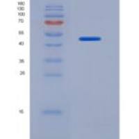 人成纤维细胞生长因子7(FGF7)重组蛋白