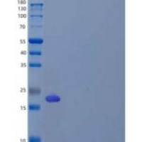 人再生胰岛衍生蛋白3γ(REG3g)重组蛋白C-6His