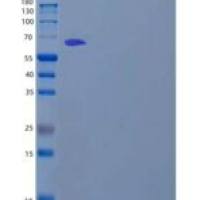 人血管内皮钙黏蛋白(CDH8)重组蛋白C-6His