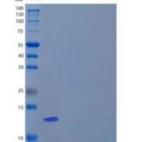 人S100钙结合蛋白P(S100P)重组蛋白N-6His