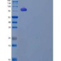 人低密度脂蛋白受体(LDLR)重组蛋白C-6His/AVI