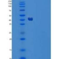 人羧肽酶A2(CPA2)重组蛋白C-6His