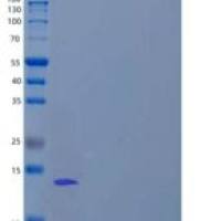 人降钙素/钙（Calcitonin/CALCA）重组蛋白C-6His