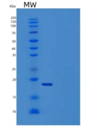 人半乳糖凝集素-14/LGALS14重组蛋白C-6His