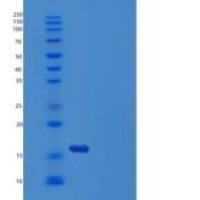 人半乳糖凝集素-1/LGALS1重组蛋白C-6His