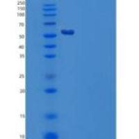 人丝氨酸羟甲基转移酶1(SHMT1)重组蛋白C-6His