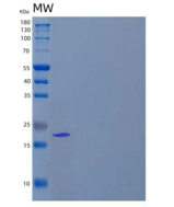 人碱性成纤维细胞生长因子(FGF2)/FGFb 重组蛋白Me