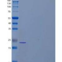 人富含亮氨酸重复序列的蛋白质3B/LRRC3B重组蛋白C-6His