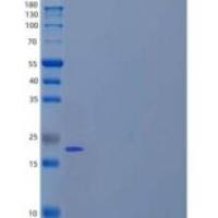 人湿结合蛋白(RTBDN)重组蛋白C-6His