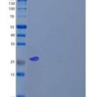 人马来酰乙酰乙酸异构酶/MAA/GSTZ1重组蛋白C-6His