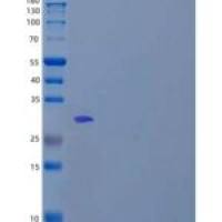 人L-Xylulose Reductase/DCXR重组蛋白N-6His